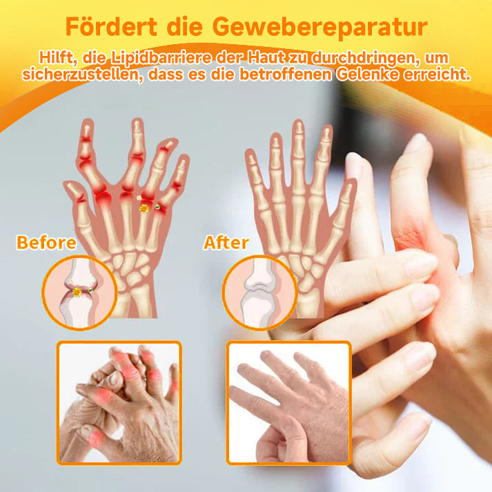 Bienen-Vital-Creme | Schnelle Schmerzlinderung | Brehn