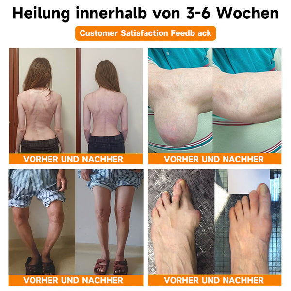 Bienen-Vital-Creme | Schnelle Schmerzlinderung | Brehn