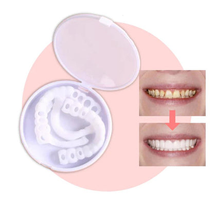 Snap-on Teeth™ – Mit diesen Veneers haben Sie immer ein perfektes Lächeln.