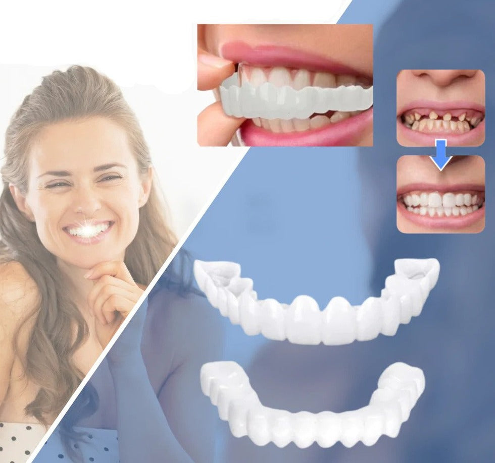Snap-on Teeth™ – Mit diesen Veneers haben Sie immer ein perfektes Lächeln.