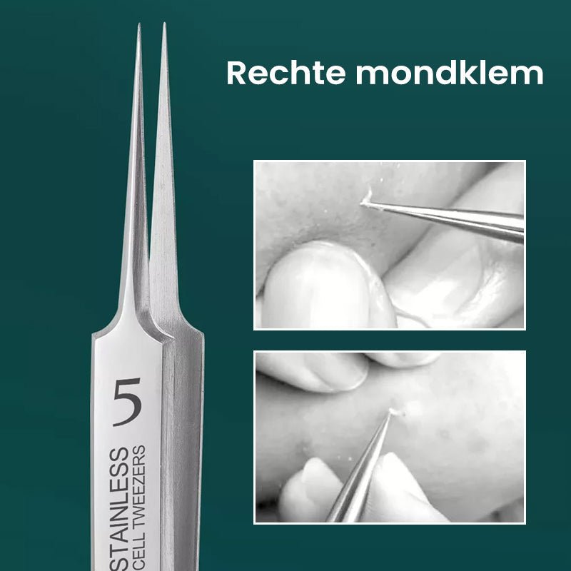 TweezeClear Gezielte Pickelentferner