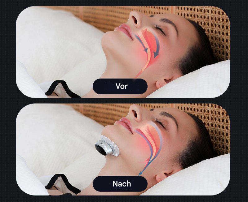 Brehn | Schlafapnoe-Hilfe - AirEase