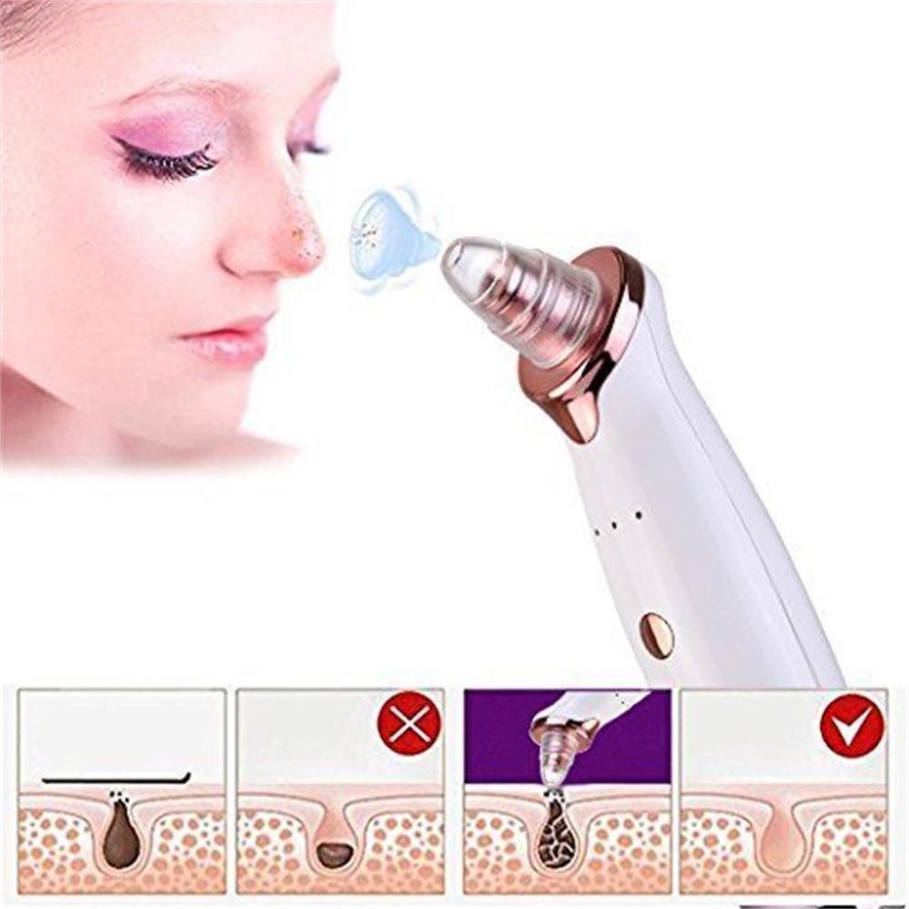 Brehn | Skin Vacuum Pro V2